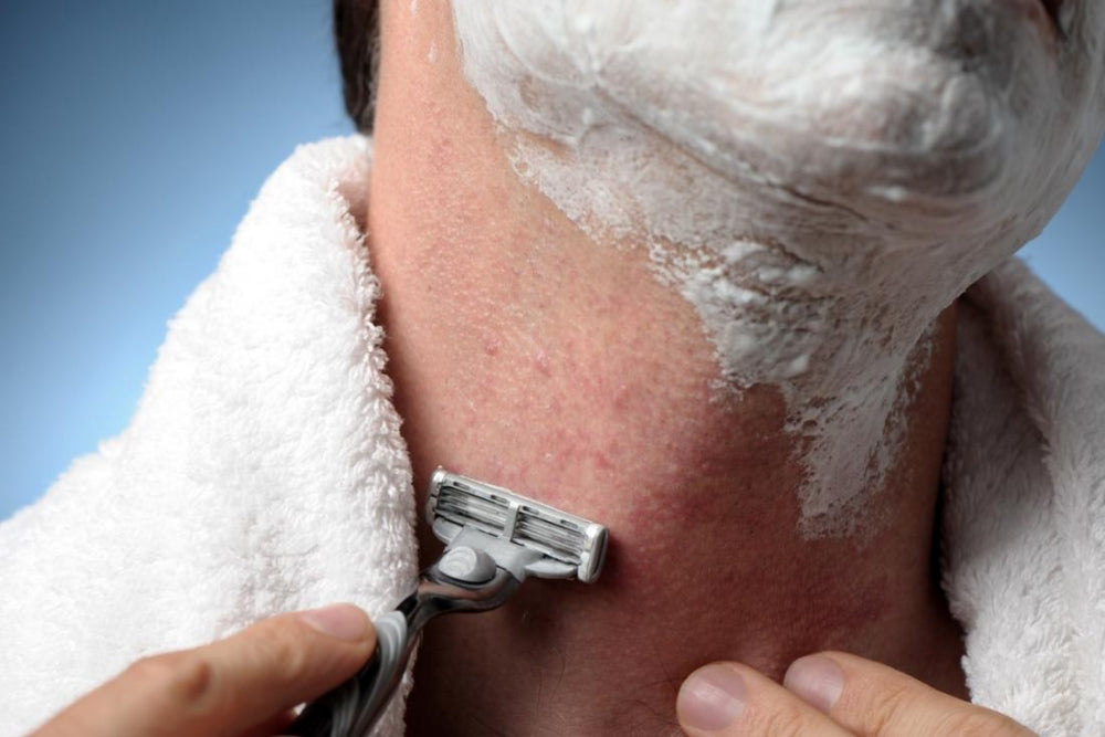 4 Ways To Prevent Razor Burn On Face